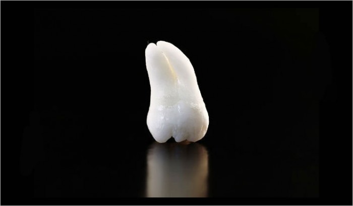 Baby and wisdom teeth are a rich source of stem cells